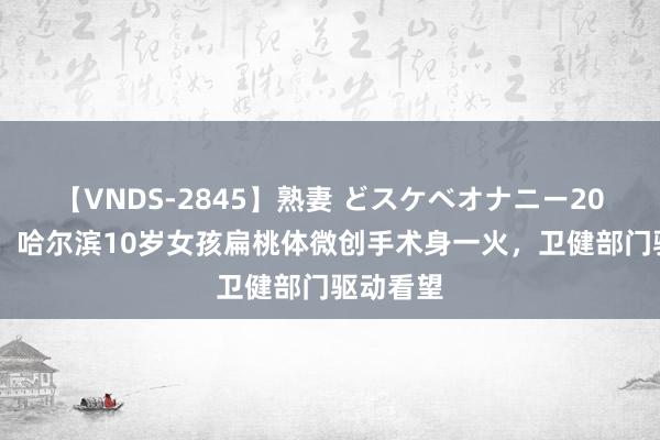 【VNDS-2845】熟妻 どスケベオナニー20連発！！ 哈尔滨10岁女孩扁桃体微创手术身一火，卫健部门驱动看望